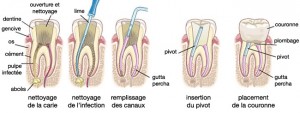 root-11