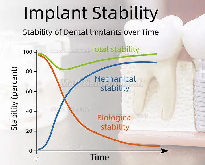 ISQ Implant Stability Measurement Module Moniteur de stabilité implantaire YAHOPE iCHECK